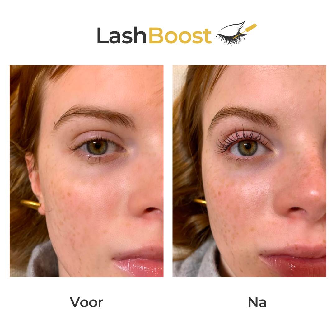 Wimperbooster™ | Wimpergroeiserum | 50% korting Beperkte aanbieding